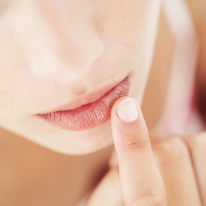 consejos imprescindibles para cuidar tus labios